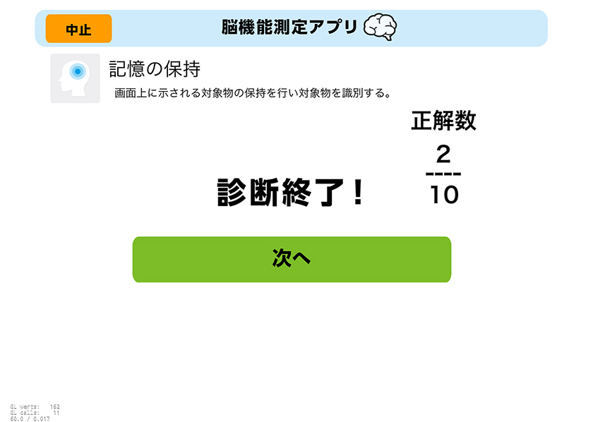 記憶の保持